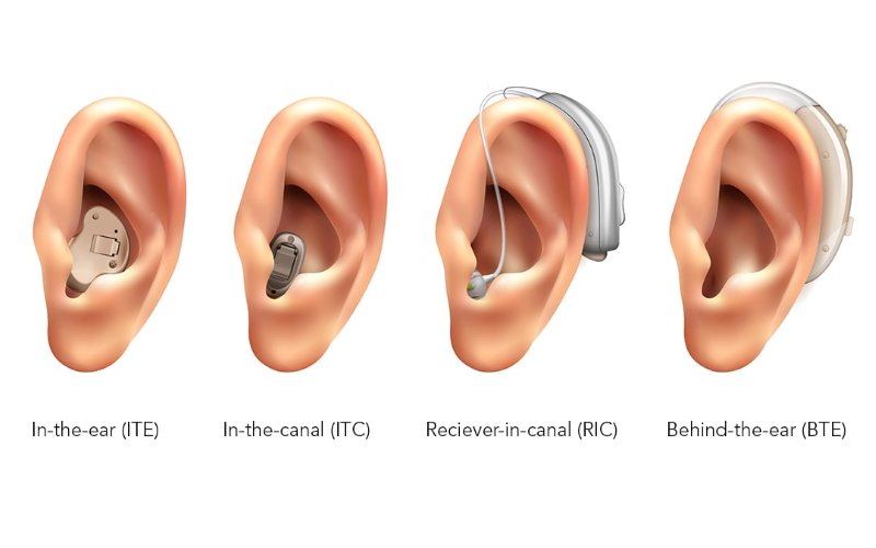Diyarbakır İşitme Merkezleri